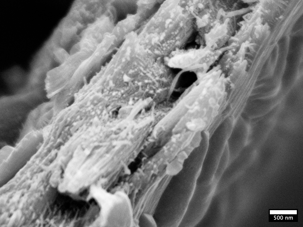 Black and white image from under a microscope of the ultrastructure of the wood from a tulip tree